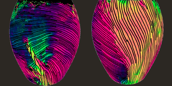 colorful medical image showing collagen structure in two rat hearts